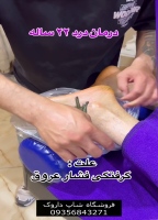 فروش زالو زنده