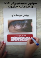 درمان انواع ریزش مو