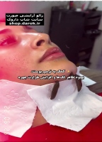 خرید زالو زنده
